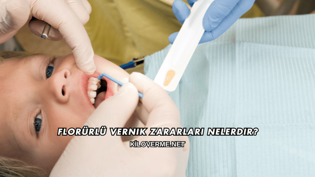 Florürlü Vernik Zararları Nelerdir?