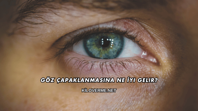 Göz Çapaklanmasına Ne İyi Gelir?