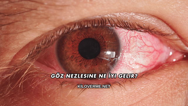 Göz Nezlesine Ne İyi Gelir?