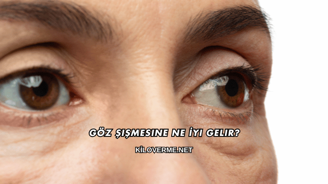 Göz Şişmesine Ne İyi Gelir?