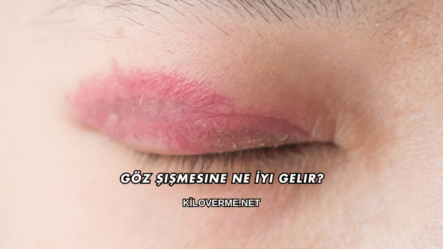 Göz Şişmesine Ne İyi Gelir?