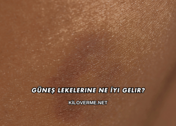 Güneş Lekelerine Ne İyi Gelir?