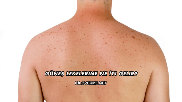 Güneş Lekelerine Ne İyi Gelir?