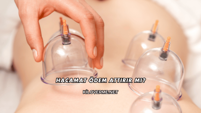 Hacamat Ödem Attırır mı?