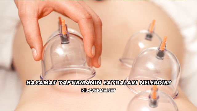 Hacamat Yaptırmanın Faydaları Nelerdir?