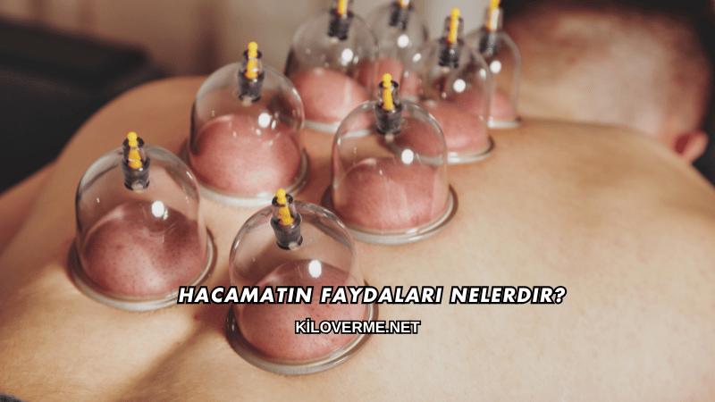 Hacamatın Faydaları Nelerdir?