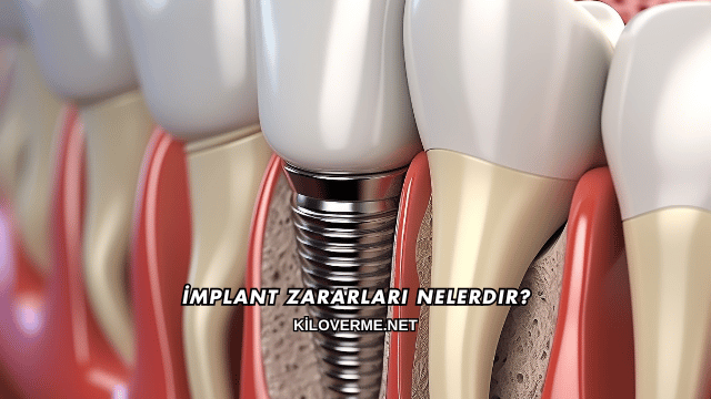 İmplant Zararları Nelerdir?