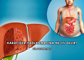 Karaciğer Yağlanmasına Ne İyi Gelir?