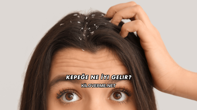 Kepeğe Ne İyi Gelir?