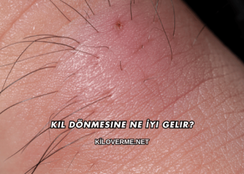 Kıl Dönmesine Ne İyi Gelir?