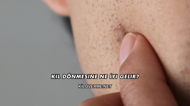 Kıl Dönmesine Ne İyi Gelir?