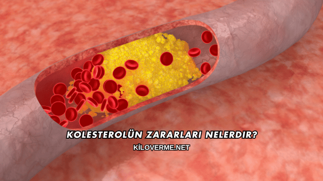Kolesterolün Zararları Nelerdir?