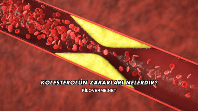 Kolesterolün Zararları Nelerdir?