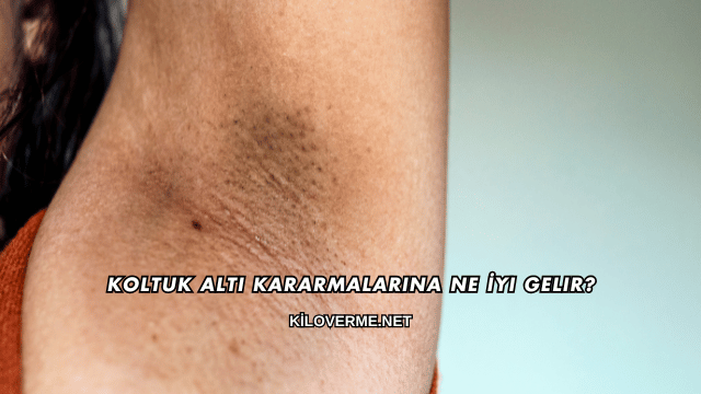 Koltuk Altı Kararmalarına Ne İyi Gelir?
