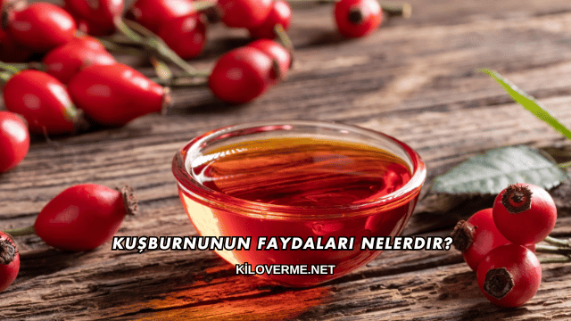 Kuşburnunun Faydaları Nelerdir?