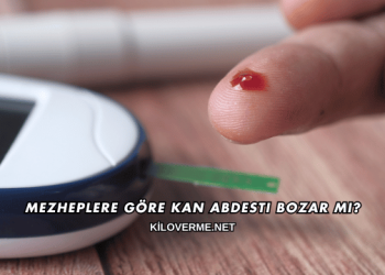 Mezheplere Göre Kan Abdesti Bozar mı?