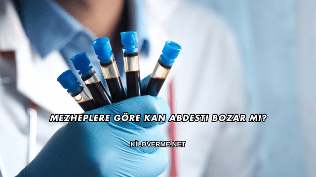 Mezheplere Göre Kan Abdesti Bozar mı?