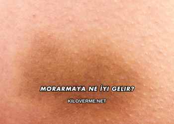 Morarmaya Ne İyi Gelir?