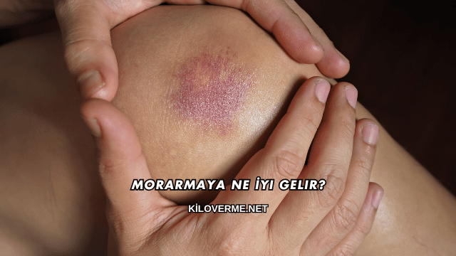 Morarmaya Ne İyi Gelir?