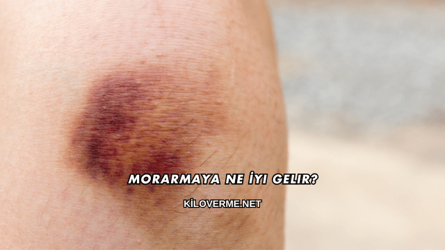 Morarmaya Ne İyi Gelir?
