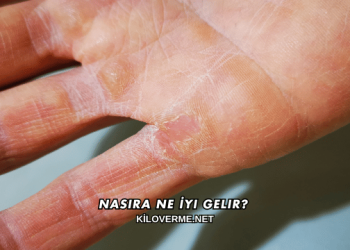 Nasıra Ne İyi Gelir?