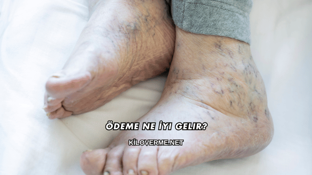 Ödeme Ne İyi Gelir?