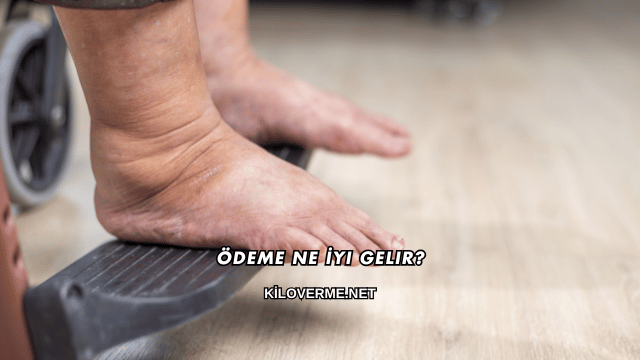 Ödeme Ne İyi Gelir?
