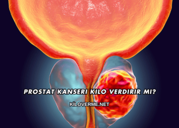 Prostat Kanseri Kilo Verdirir mi?