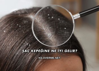 Saç Kepeğine Ne İyi Gelir?