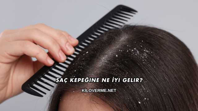 Saç Kepeğine Ne İyi Gelir?