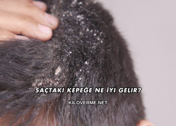 Saçtaki Kepeğe Ne İyi Gelir?