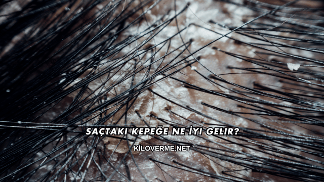 Saçtaki Kepeğe Ne İyi Gelir?