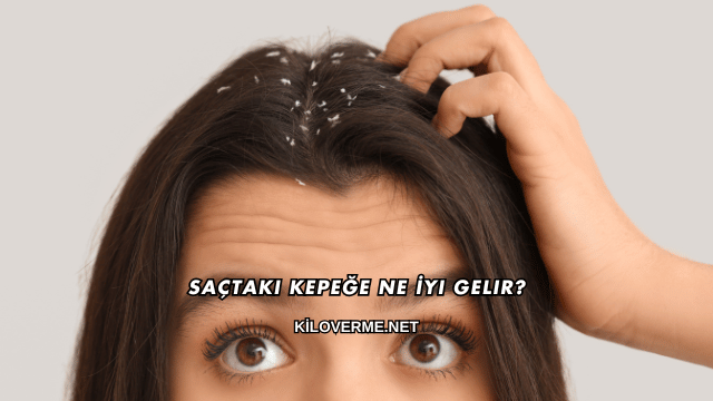 Saçtaki Kepeğe Ne İyi Gelir?