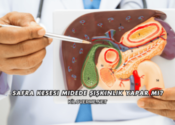 Safra Kesesi Midede Şişkinlik Yapar mı?
