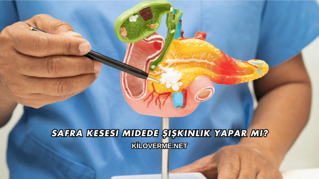 Safra Kesesi Midede Şişkinlik Yapar mı?