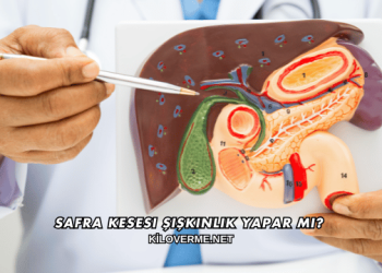 Safra Kesesi Şişkinlik Yapar mı?