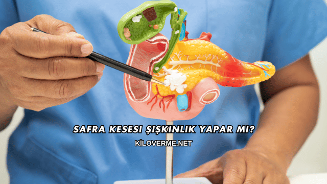 Safra Kesesi Şişkinlik Yapar mı?