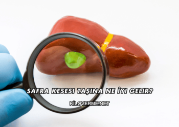 Safra Kesesi Taşına Ne İyi Gelir?