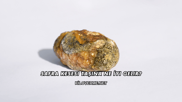 Safra Kesesi Taşına Ne İyi Gelir?