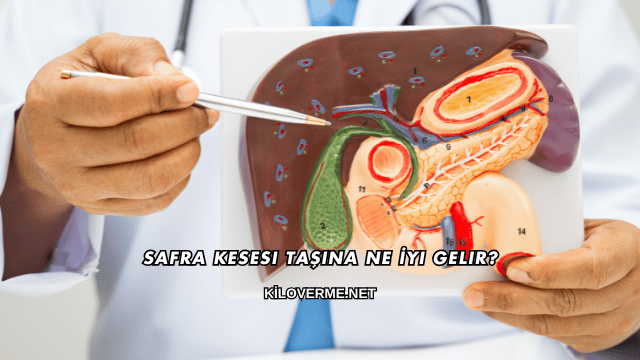 Safra Kesesi Taşına Ne İyi Gelir?