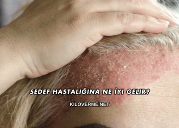 Sedef Hastalığına Ne İyi Gelir?