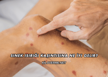 Sinek Isırığı Kaşıntısına Ne İyi Gelir?