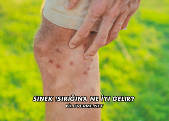 Sinek Isırığına Ne İyi Gelir?