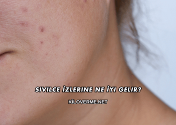 Sivilce İzlerine Ne İyi Gelir?