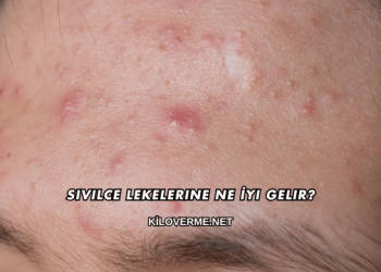 Sivilce Lekelerine Ne İyi Gelir?