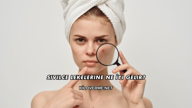 Sivilce Lekelerine Ne İyi Gelir?