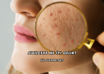 Sivilceye Ne İyi Gelir?