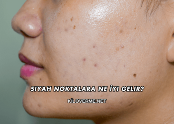 Siyah Noktalara Ne İyi Gelir?