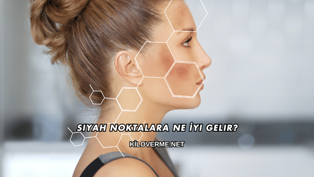 Siyah Noktalara Ne İyi Gelir?