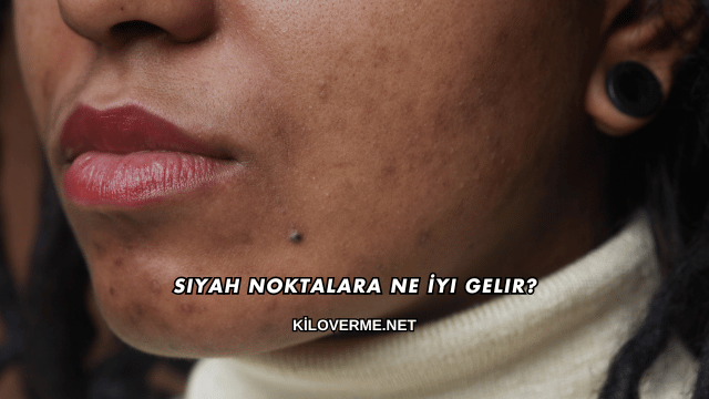 Siyah Noktalara Ne İyi Gelir?